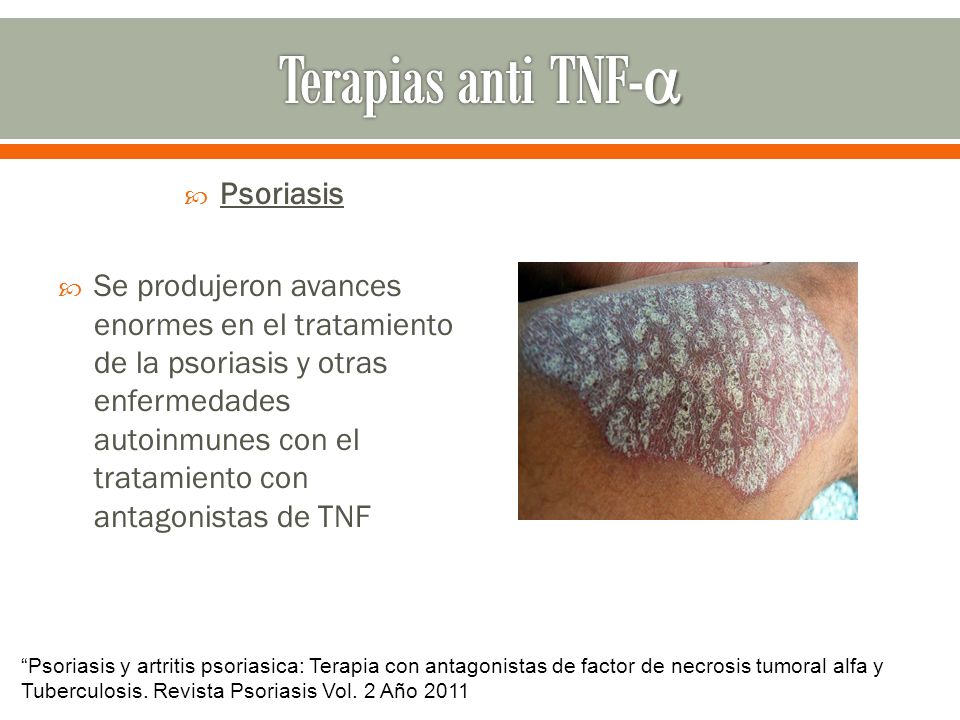 Pertsovaya la máscara a la psoriasis
